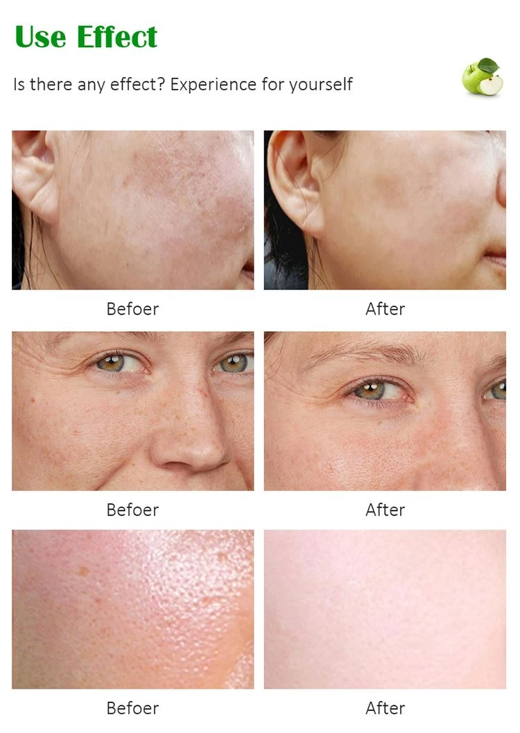 winter night cream for oily skin winter night cream for oily skin